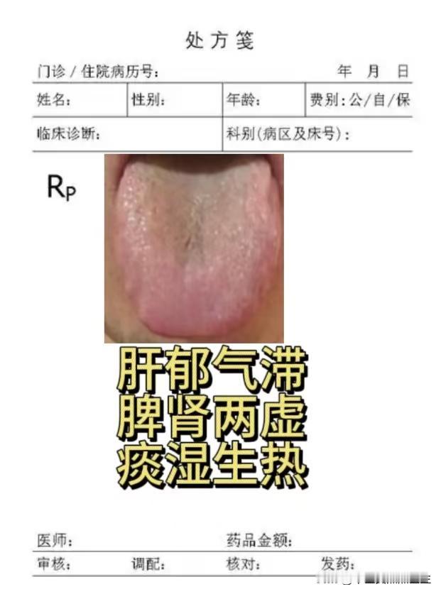 这舌象想要调理也不难，难就难在容易反复，不易除根，一定要管住自己！

患者主诉：