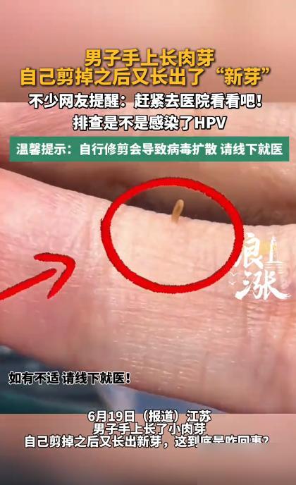 悲剧还是发生了！江苏南京，一男子手背上莫名冒出个小米粒大的肉色小疙瘩，不痛不痒但