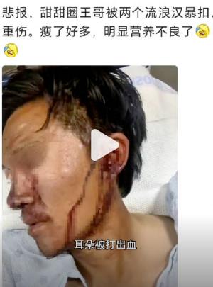 刚刚看“甜甜圈”王伟恒发视频说“当你快饿死的时候，那你就去偷、就去抢，因为这是道
