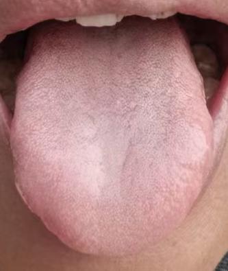 肝气郁结 + 下焦湿热，悄悄影响男性健康状态







对于男性同志而言，最