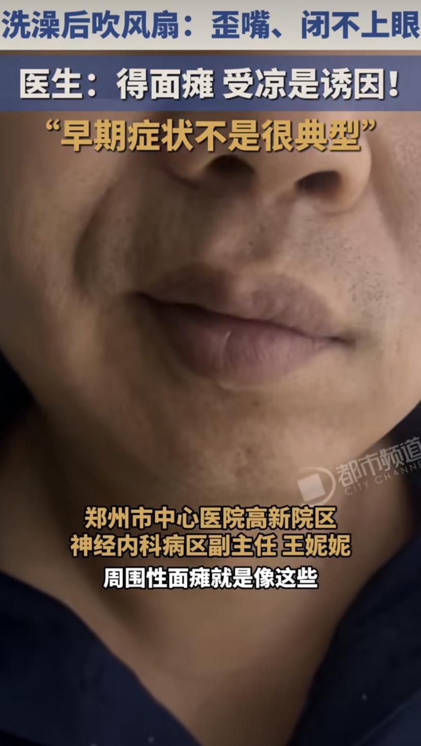 小伙贪凉整夜对脸吹风扇，早起嘴歪眼斜吓坏家人
这大热天的，吹风扇可得悠着点!河南