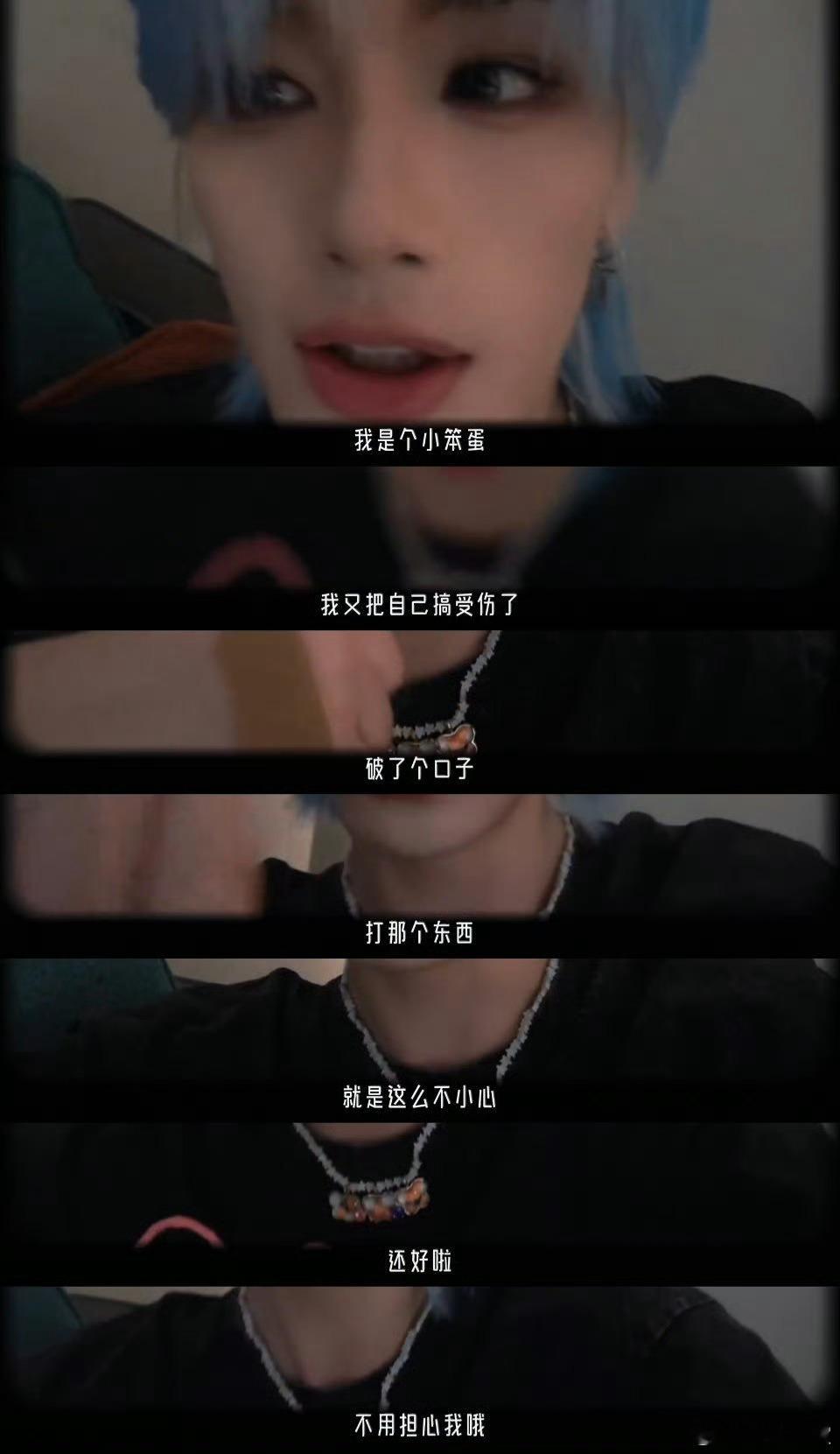 丁程鑫回应手伤情况说：“还是会肿，因为它，断掉了”，天呐当时居然是断掉了吗好严重