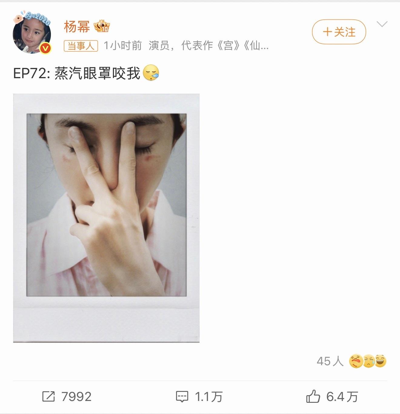 杨幂脸被蒸汽眼罩烫伤了参加活动经常会发蒸汽眼罩，我一直觉得那东西不安全有烫伤风险