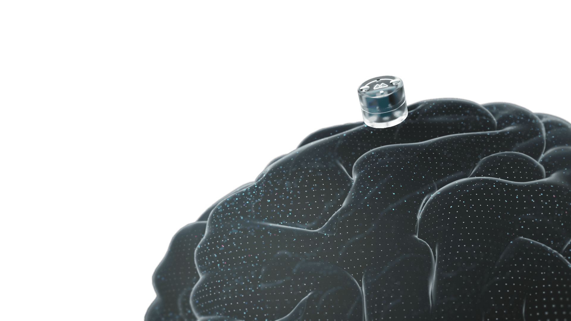 Motif Neurotech非侵入式脑机接口获FDA批准启动抗抑郁临床试验5月