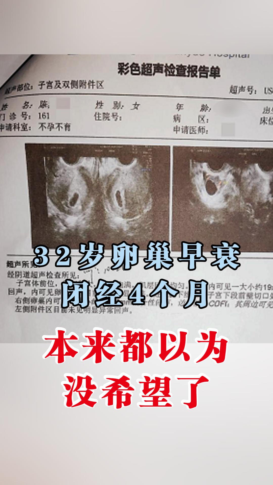 我接诊过一位32岁的王女士，上班族，备孕两年有余，四个月前突然闭经，就...