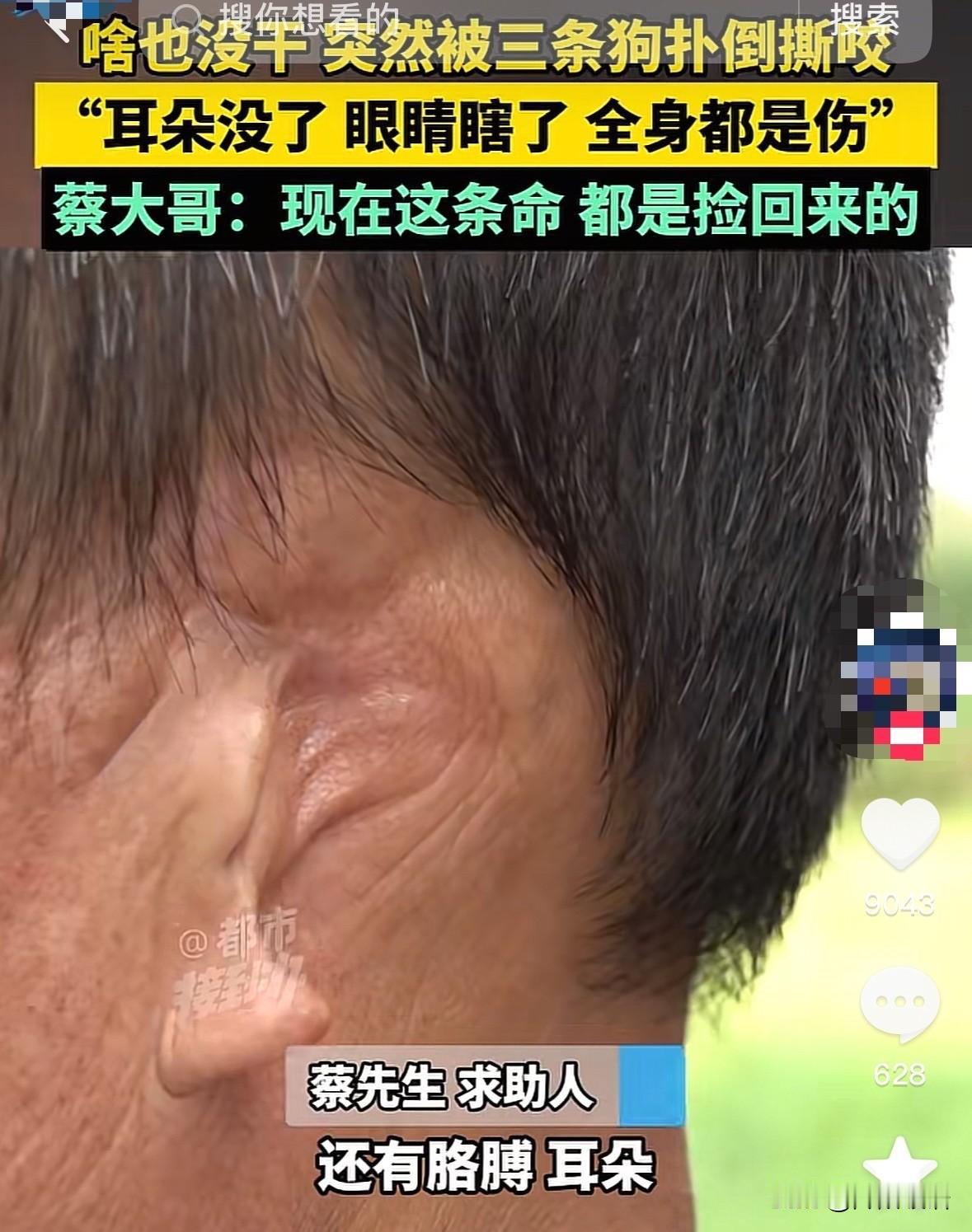啥也没干，突然被三条狗扑倒，
耳朵没了，眼睛瞎了，全身都是伤，

河南郑州，蔡大