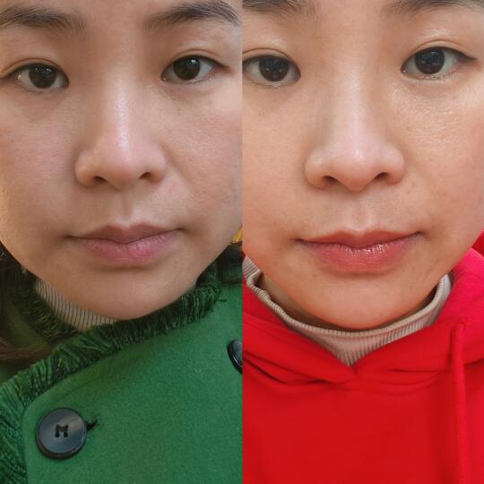 她们都说，这脸堪比整容了🔥