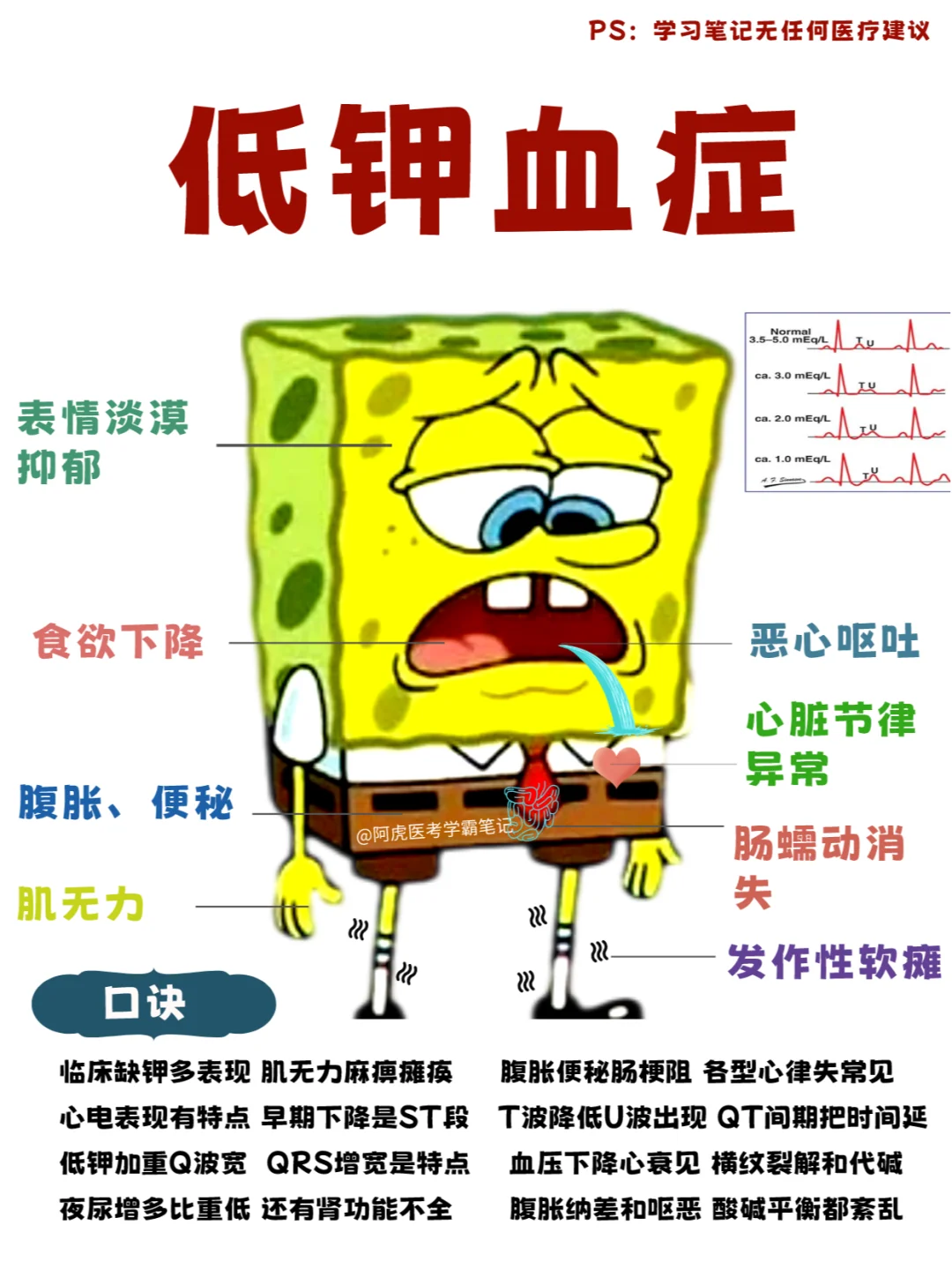 阿虎医考学霸笔记：当海绵宝宝得了低钾血症