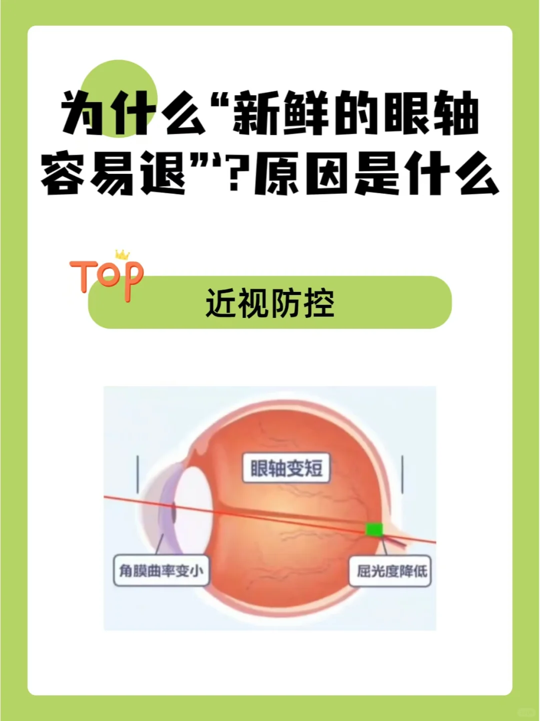为什么“新鲜的眼轴容易退”’?原因是什么?
