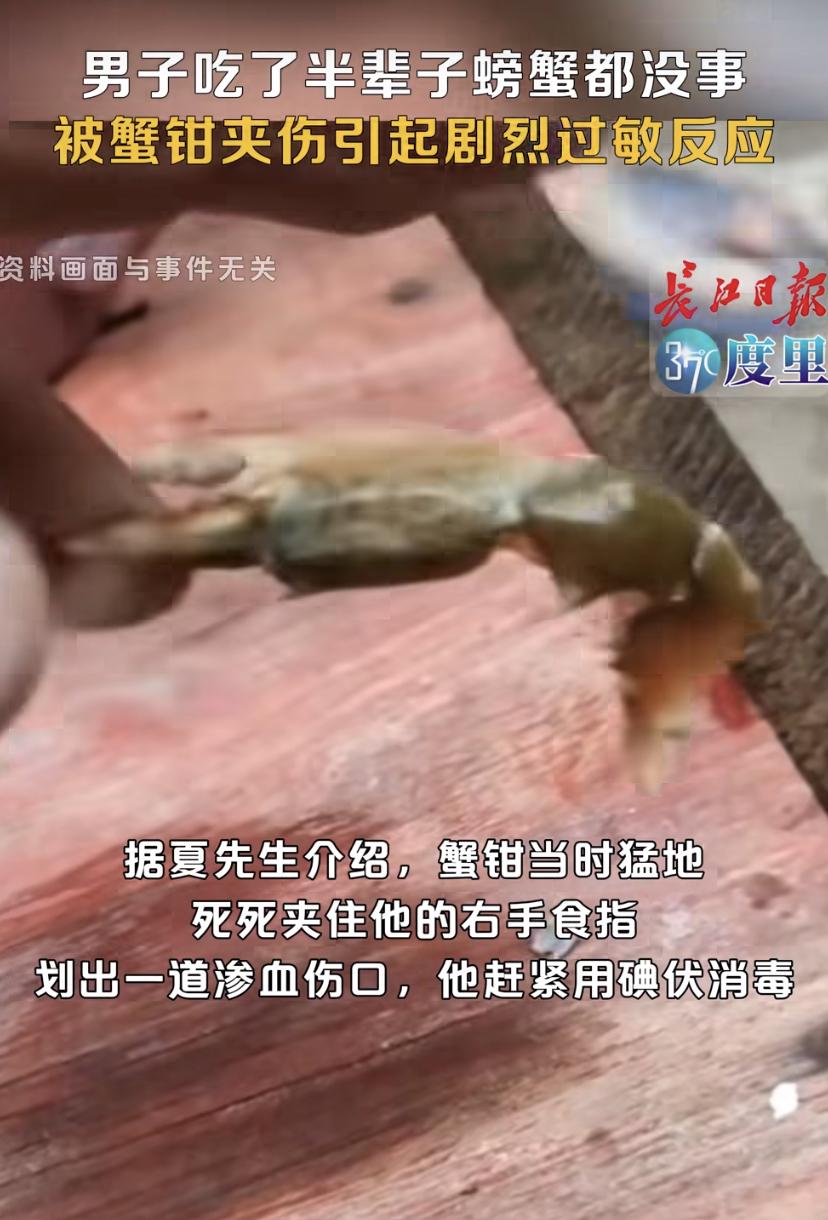 武汉58岁的夏先生，吃了一辈子螃蟹海鲜都没出过岔子，结果这回“栽"在了一只活蟹手