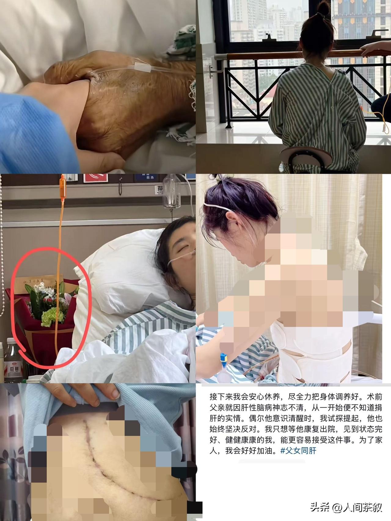 她是洪家老二，家里一共三个姐妹，父亲肝病晚期躺在ICU，迟迟等不到肝源。三姐妹商