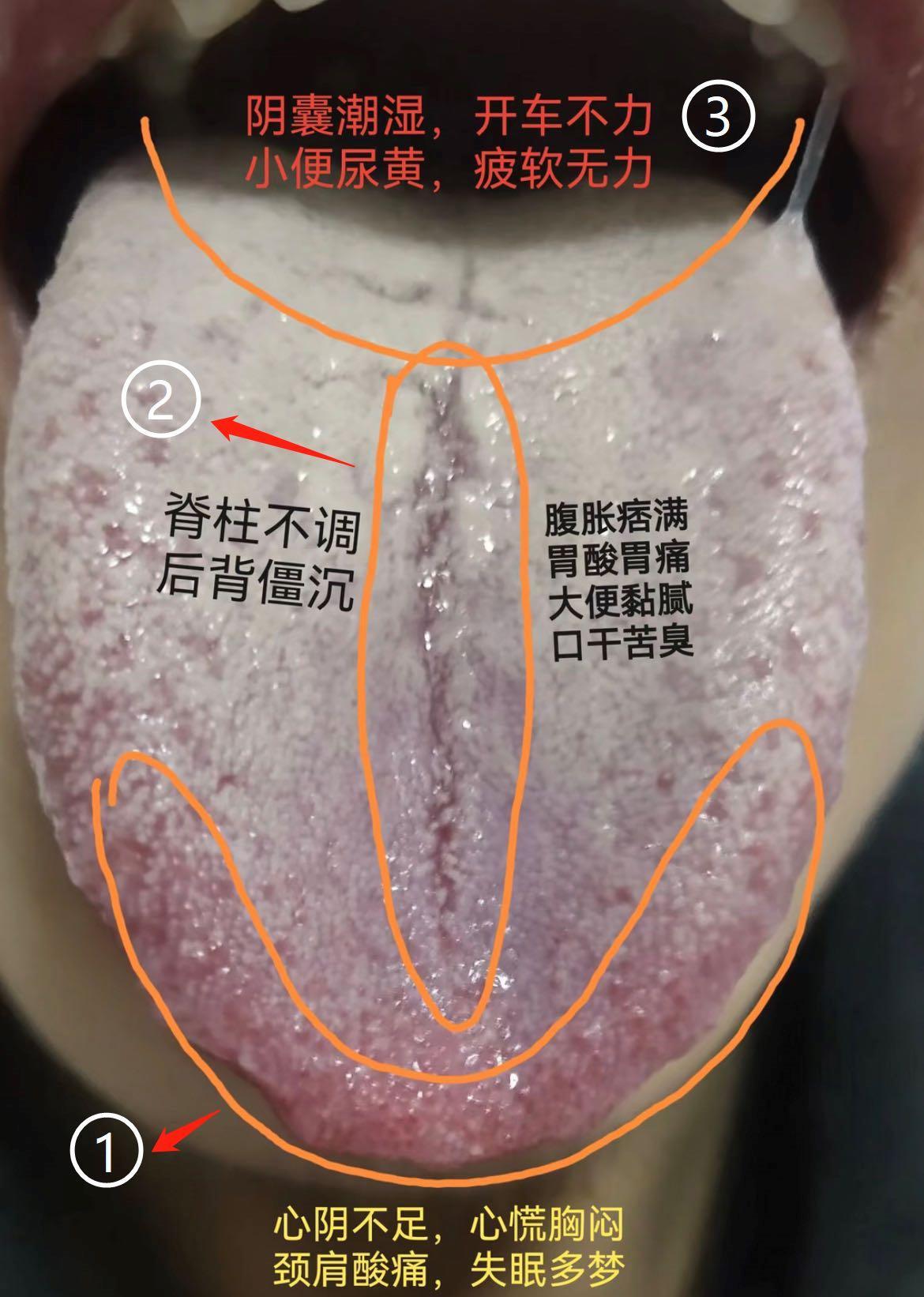 挑战一个月看1000个舌象，已经看了426个舌象！你发我分析，现出结果！
 
注