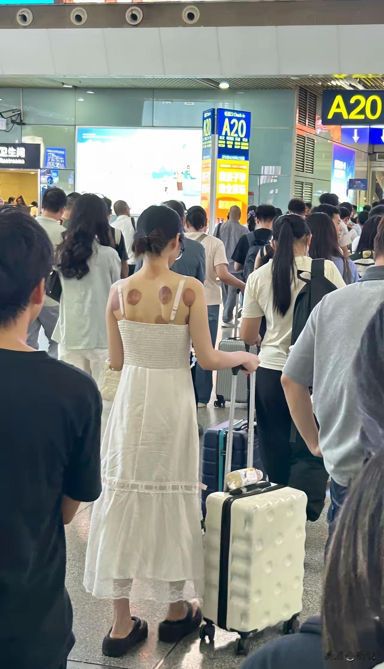 这是养生还是不养生，拔罐穿吊带，不应该注意保暖嘛
