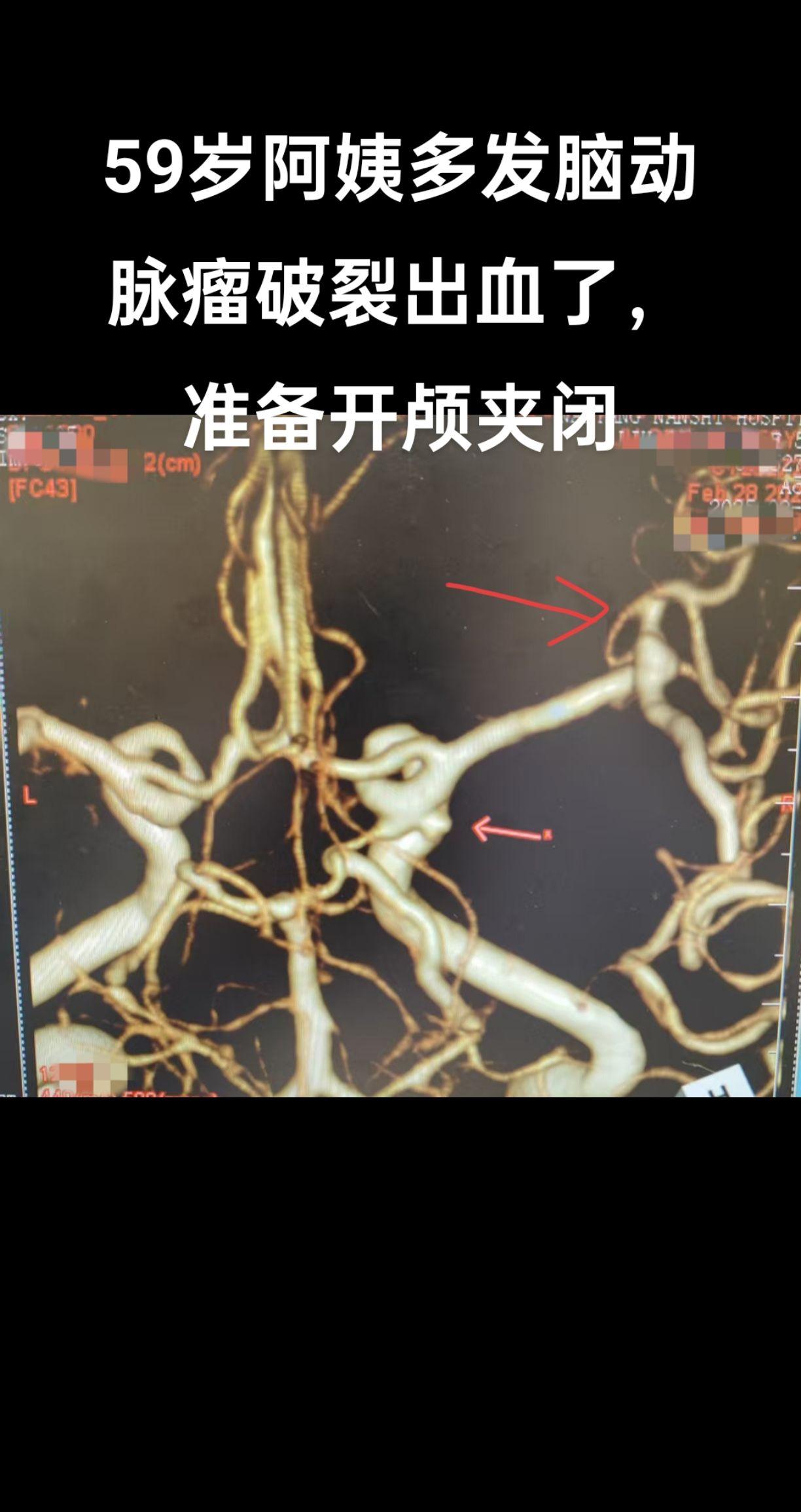 医学科普 抖医医生