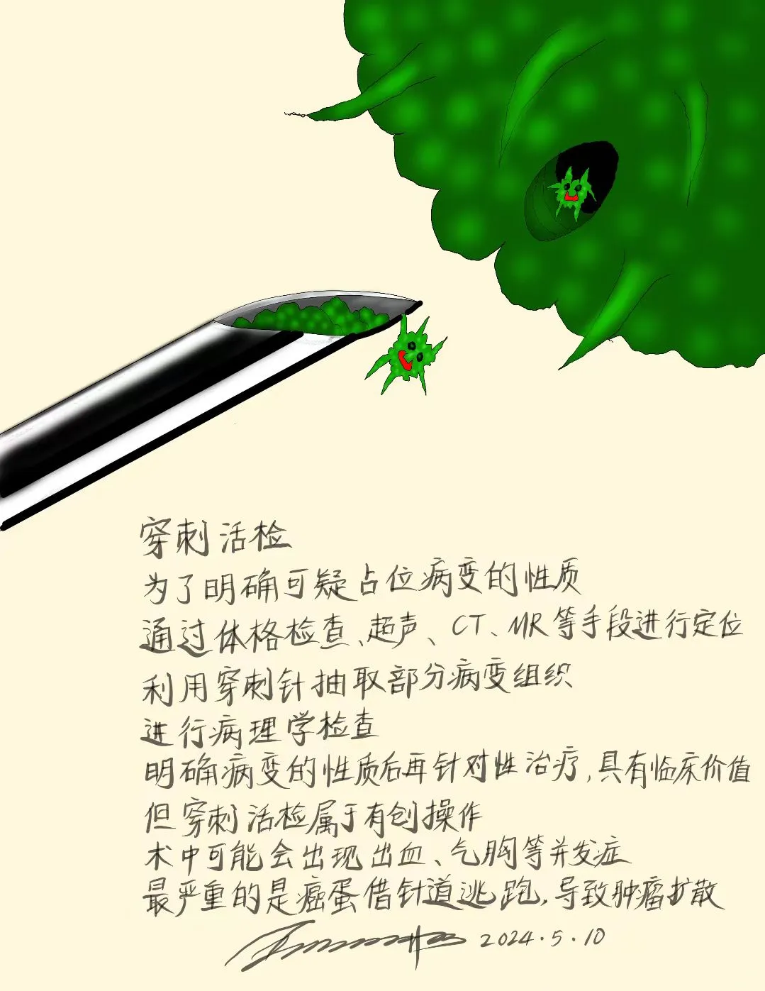 穿刺活检