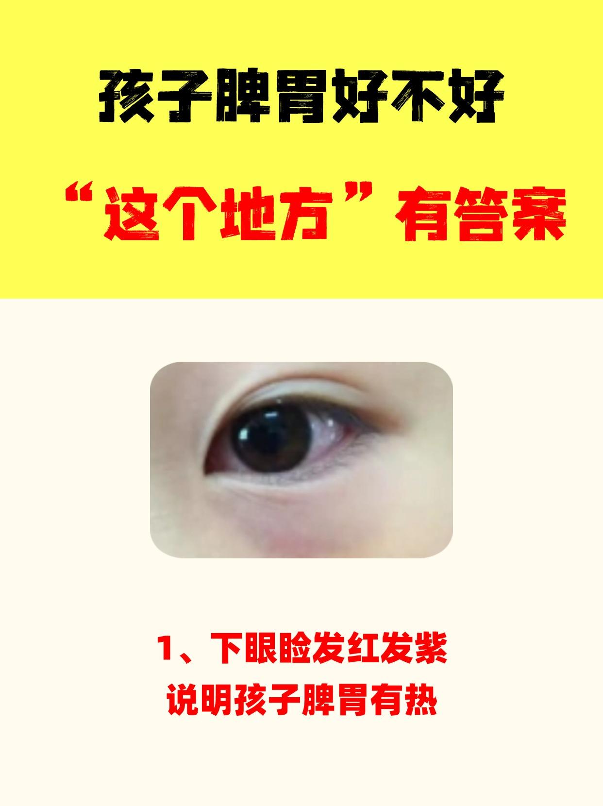 孩子脾胃好不好，这个地方有答案。
