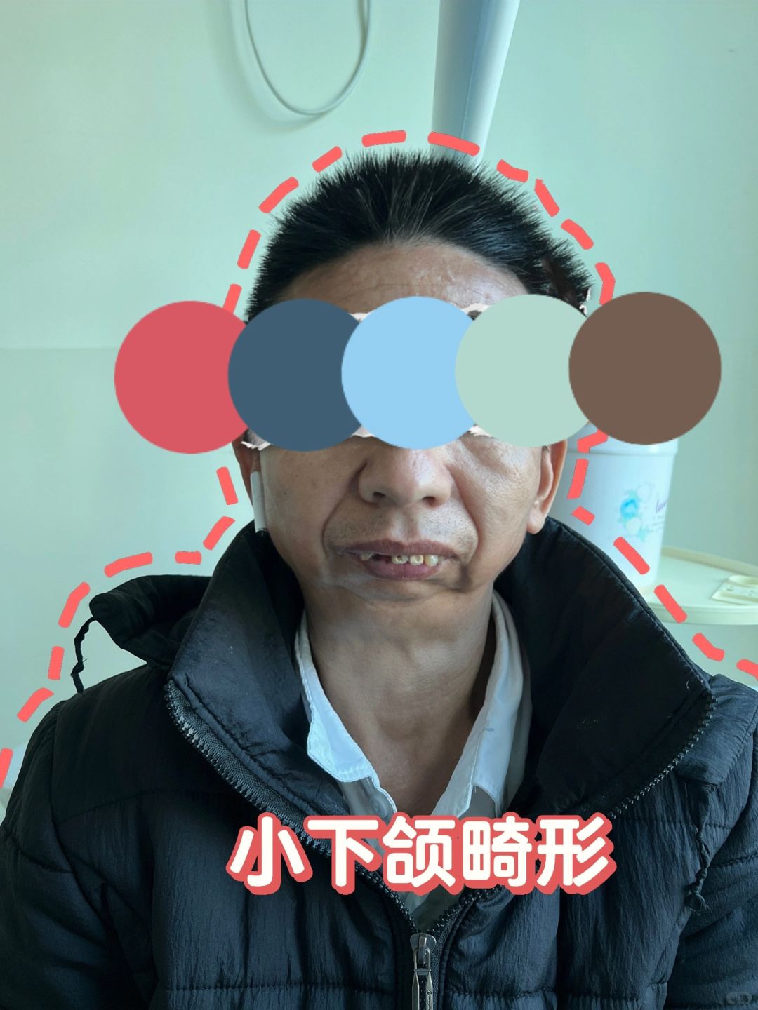 天啊～这人为什么没有下巴？