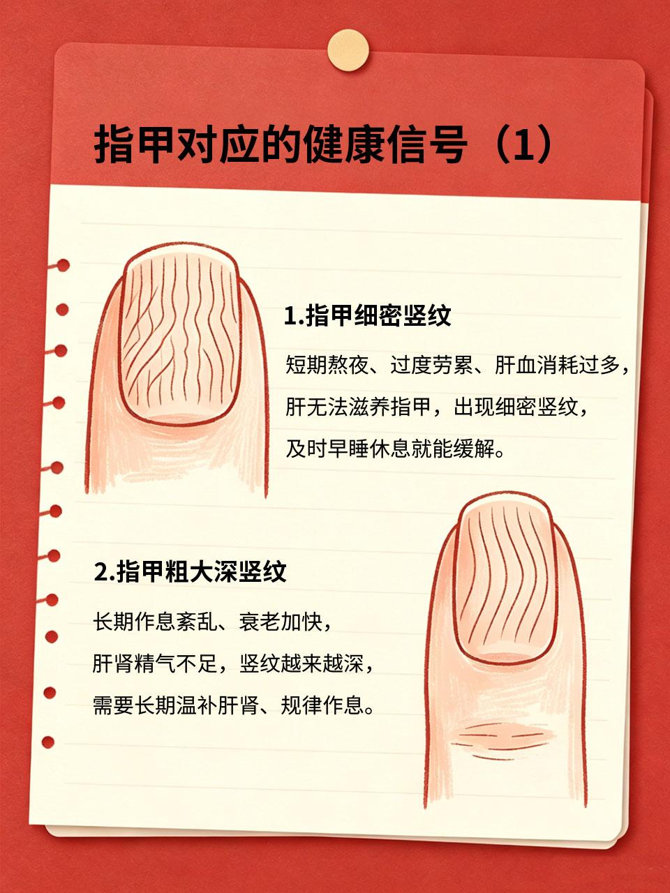 指甲长竖纹、有白点，都是健康信号，千万别忽视
指甲是身体的外在反射区，很多人指甲