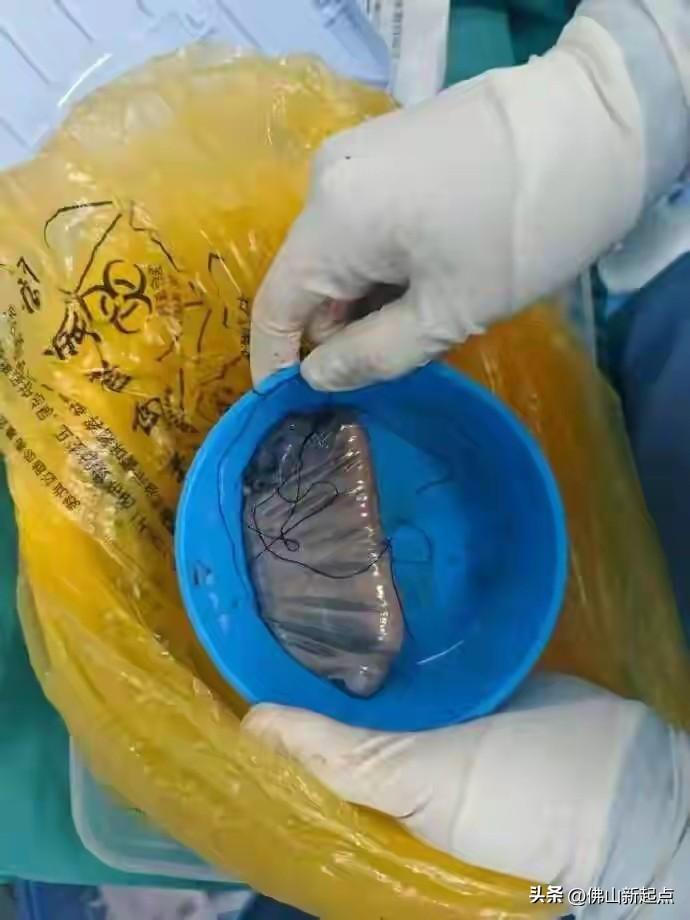 这男子的操作简直让人惊掉下巴！3月有新闻说，重庆一男子出于好奇网购水银，还用乳胶