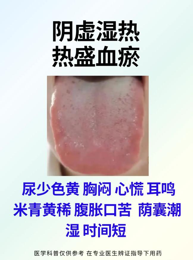 科普：中医舌诊辨证论治！