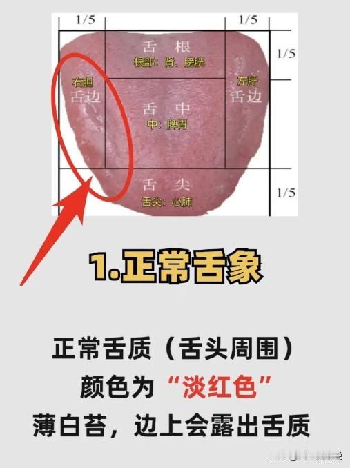 每个人体质都是不一样的，别人吃的药，你不要乱跟风。
一起看看几个常见的体质分类吧