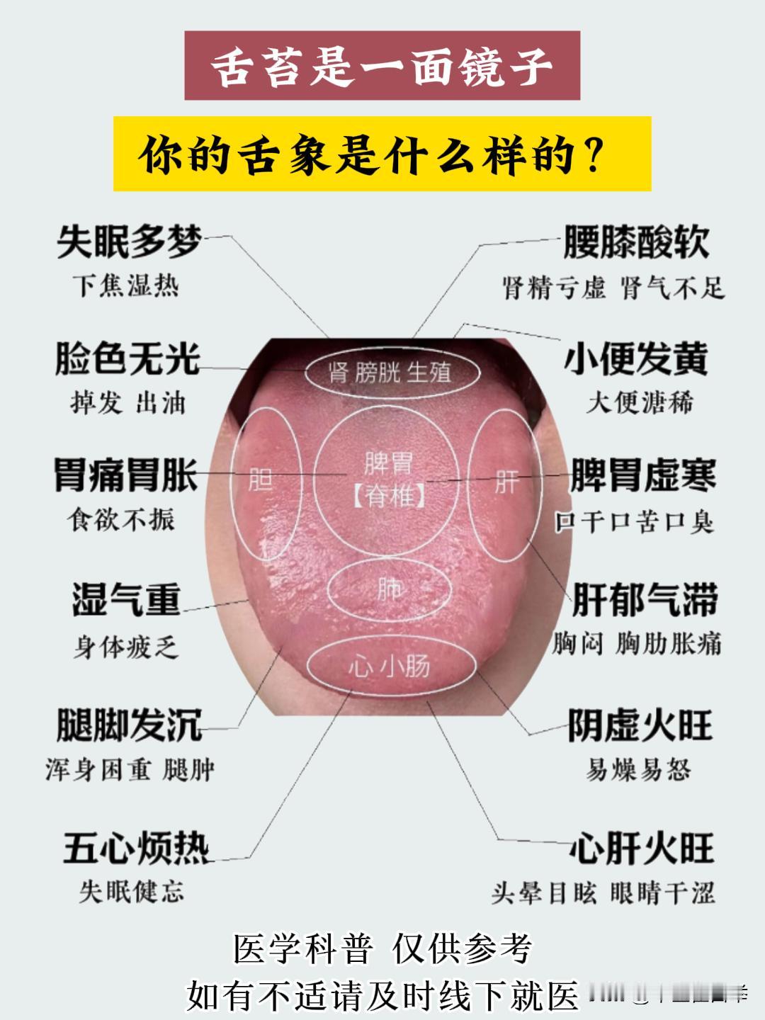 舌头就是人体健康的一面镜子，一分钟教会你看舌诊！