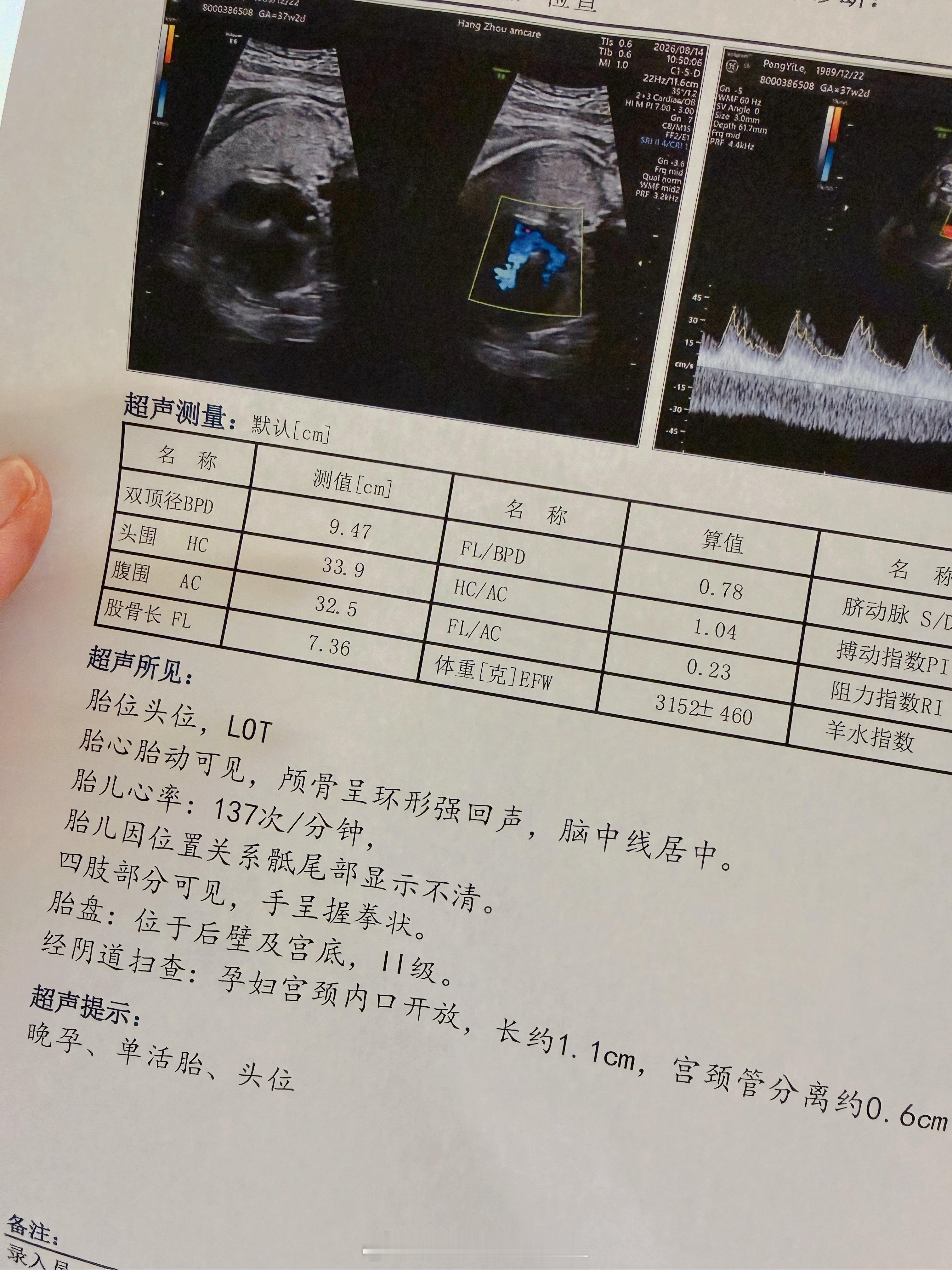 腿长长了！6.3斤！还可以还可以~ 
