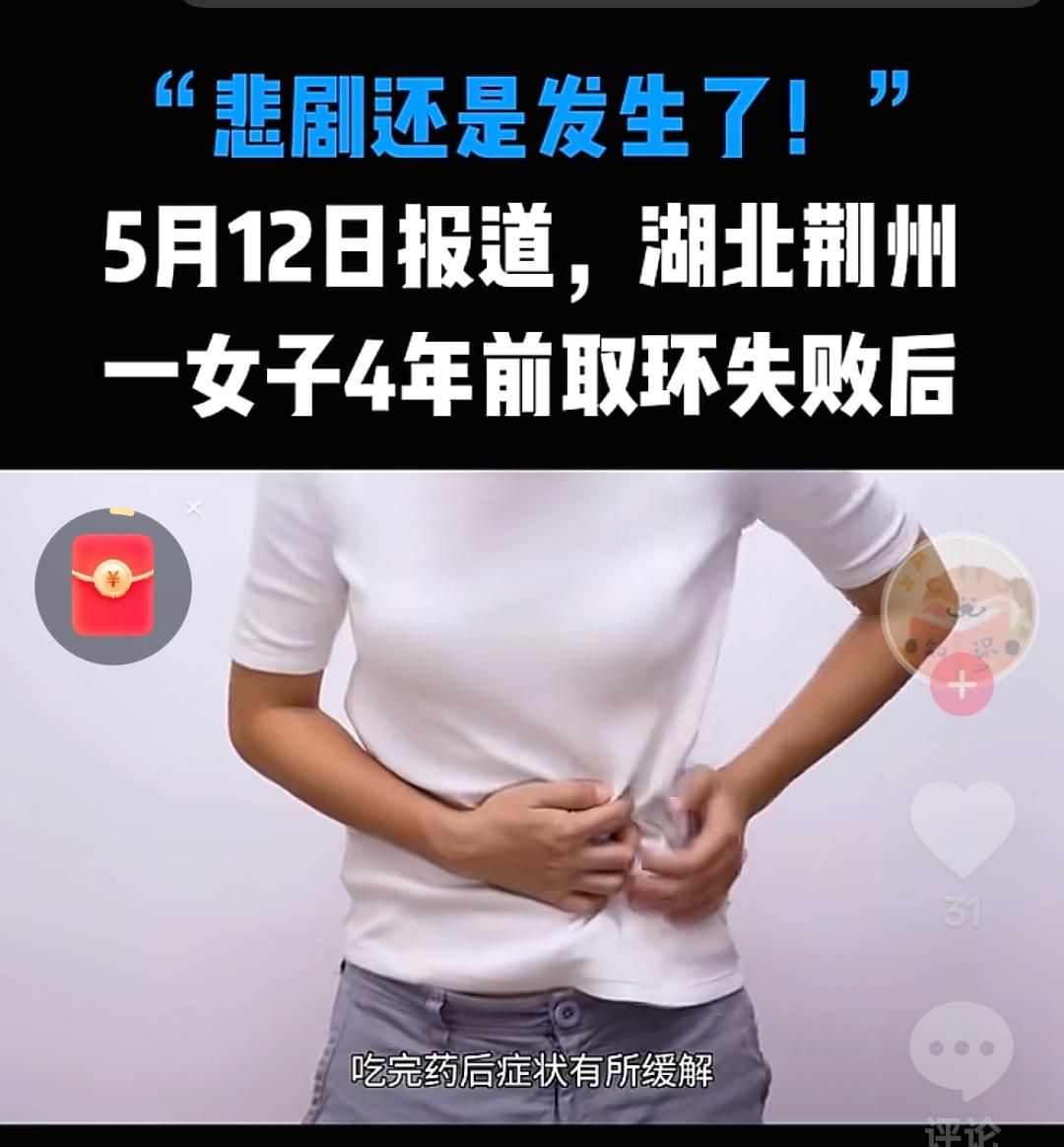 5月12日，湖北荆州，一女子4年前取环失败后，她就再没去医院复查，后来她腹部疼痛
