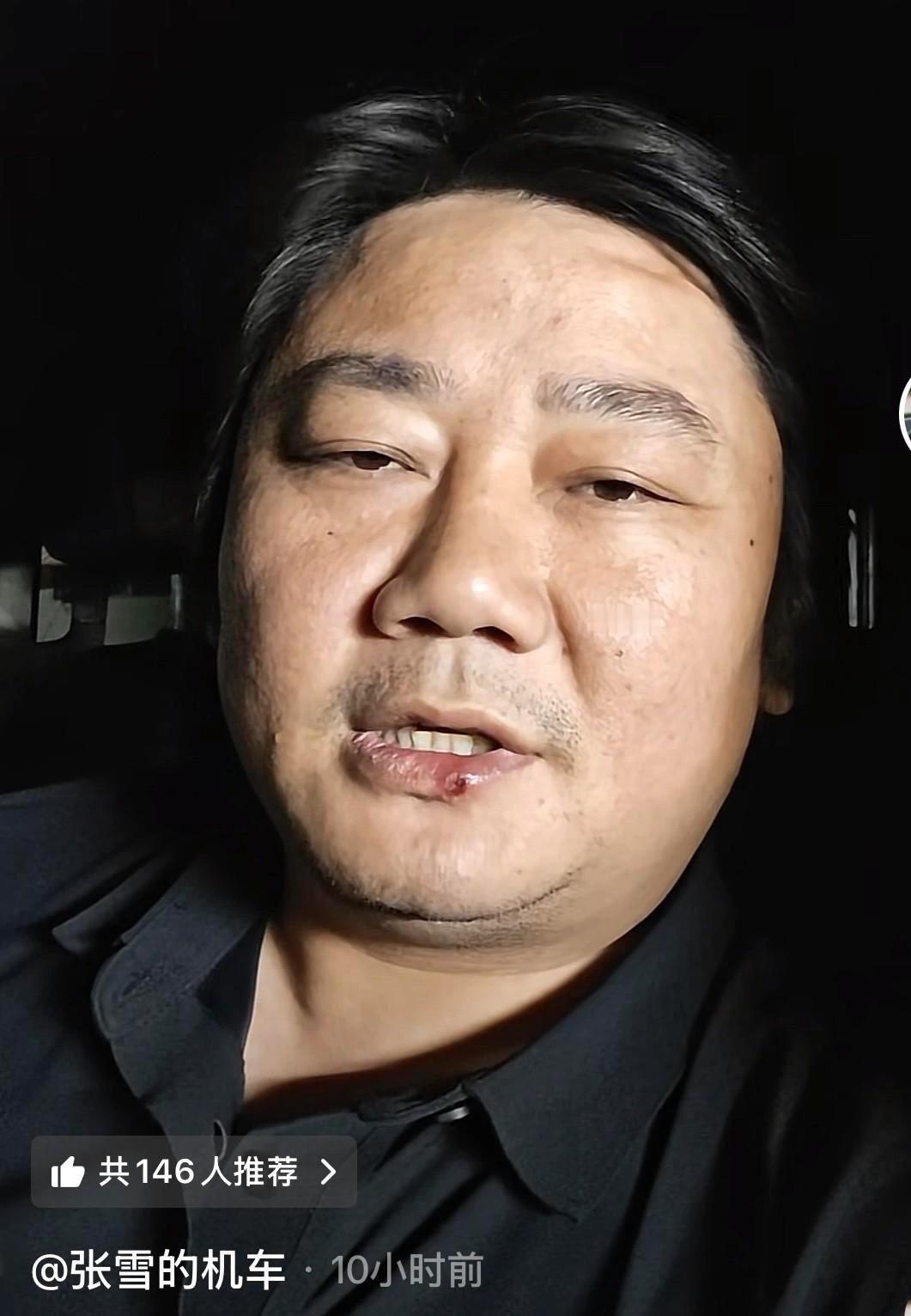 距离赛季结束还有4个月。
张雪坐不住了。昨晚半夜他公开发声，话说得很直：把发票晒