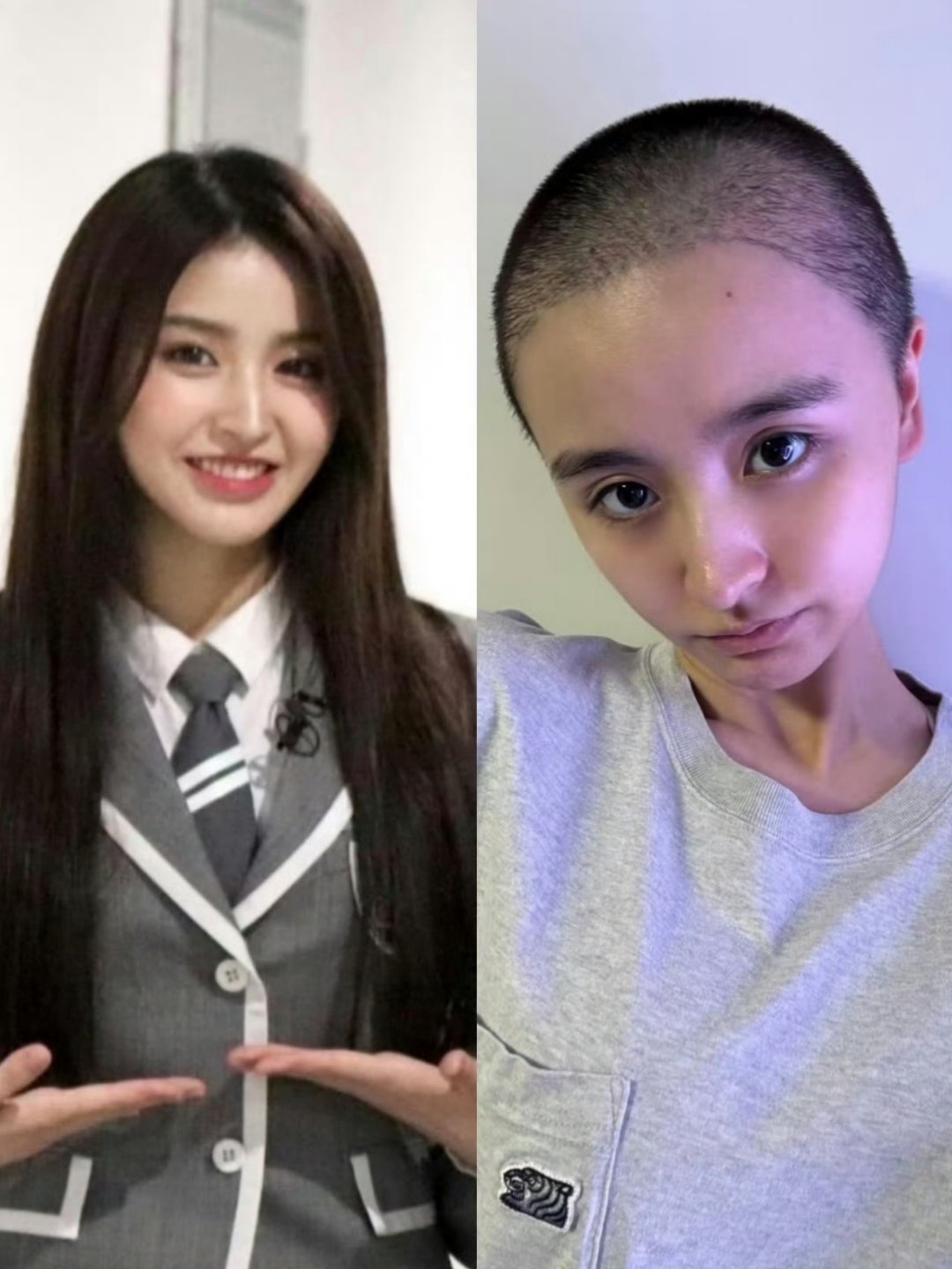 金子涵直播疑似求救金子涵手臂 前女团美女金子涵直播爆料，三年前被以"除痘消炎"为