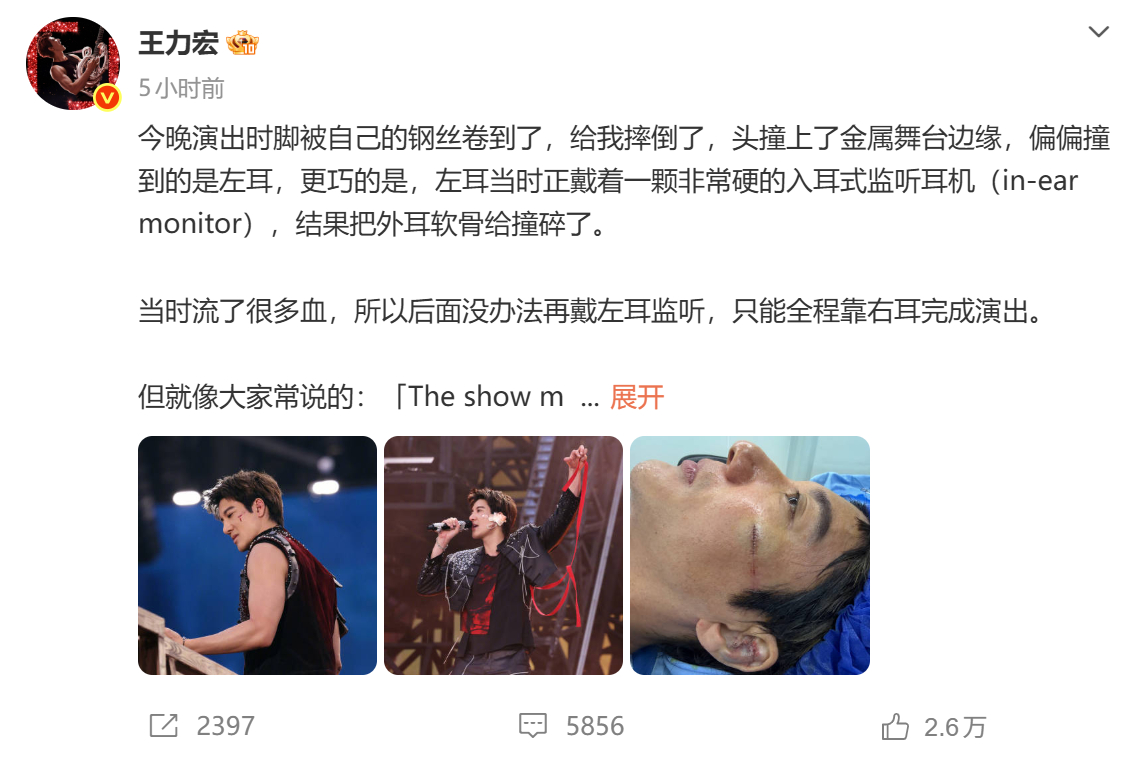 #王力宏回应演出摔倒受伤# 【演出时摔倒撞上舞台边缘，王力宏缝了39针】#演出时