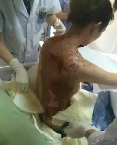 兔子急了会咬人，别把老实人逼到墙角！
2015年浙江一林姓女子在一网红火锅店用餐