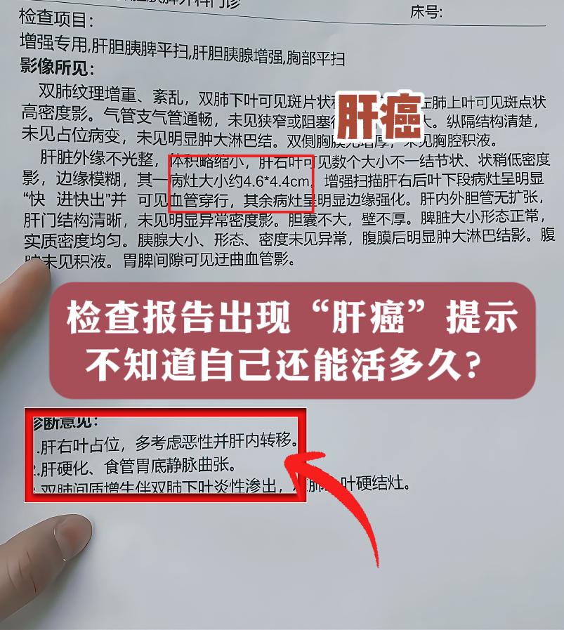 检查报告出现“肝癌”提示，不知道自己还能活多久？ 真没想到，刚退休2年...