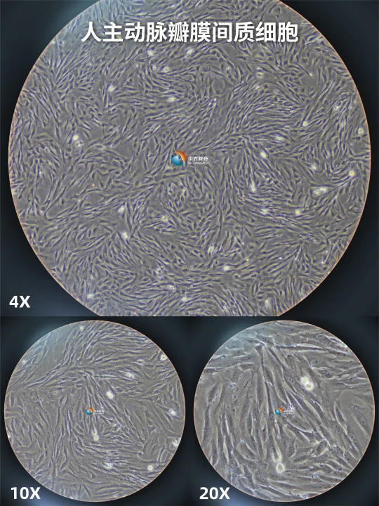 人主动脉瓣膜间质细胞，不知道养的怎么样