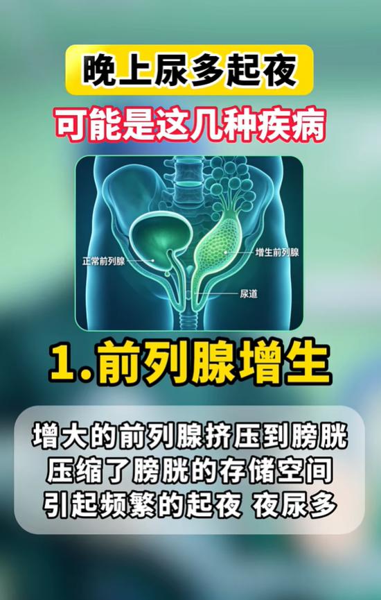 夜里频繁起夜别忽视！多半和前列腺、膀胱、睡眠问题有关