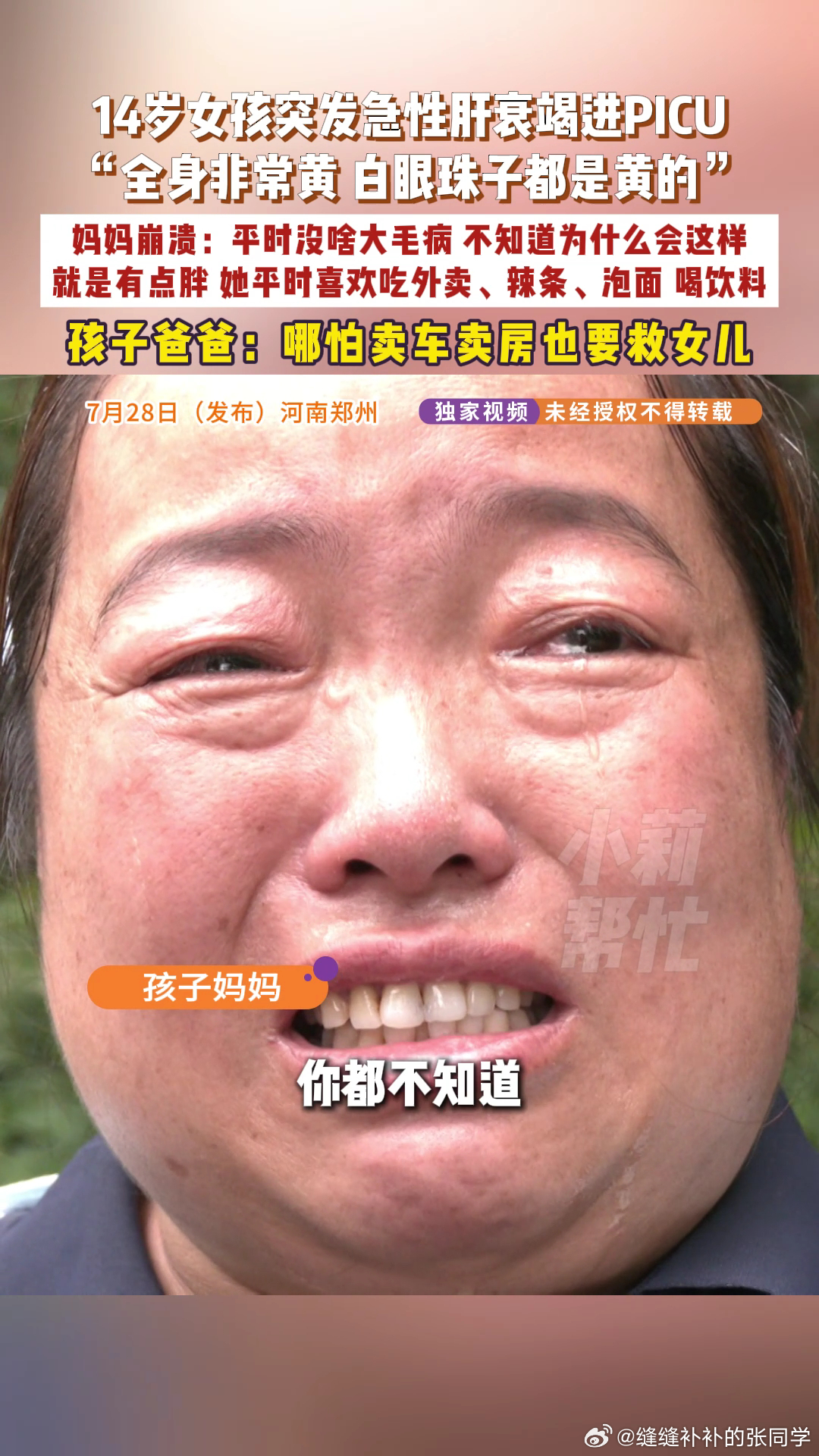 14岁140斤女孩突然皮肤发黄确诊肝衰竭14岁女孩爱吃外卖突发肝衰竭  才14岁