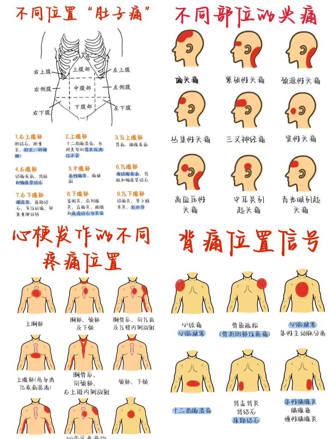 医学生笔记——“不同部位”疼痛合集