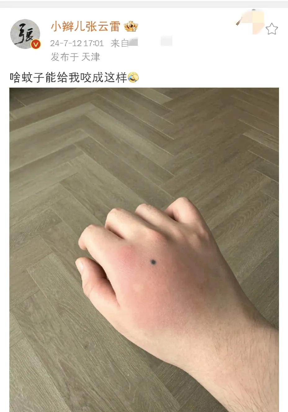 张云雷，太惨了[泪奔]

 7月12日傍晚，许久未见的张云雷罕见的发了个动态，看