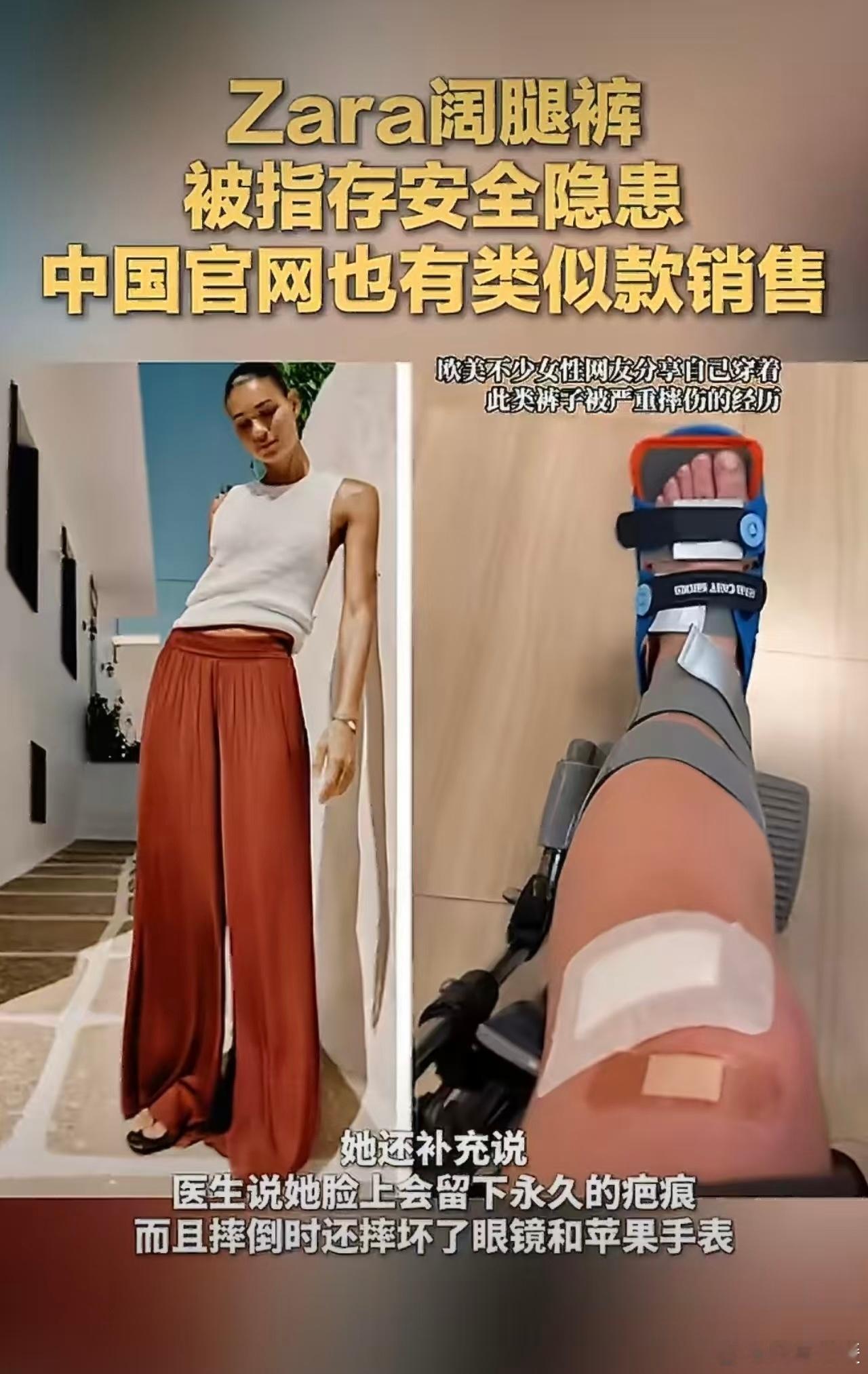 Zara阔腿裤存安全隐患阔腿裤多少确实会有安全隐患，尤其是拖地的阔腿裤。还可能会