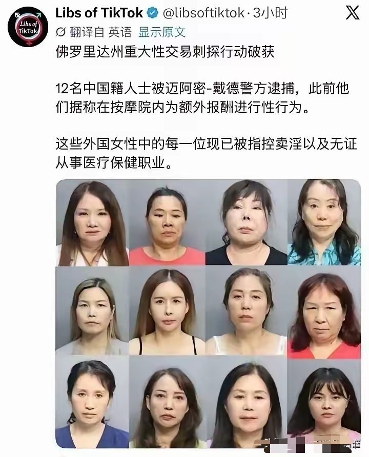 只要去美国，脸都胖多了。 