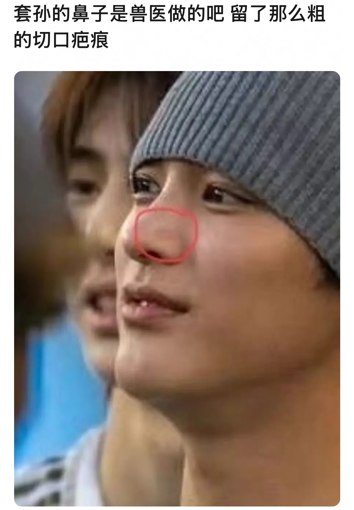 网友辣评安乾镐和严成玹 