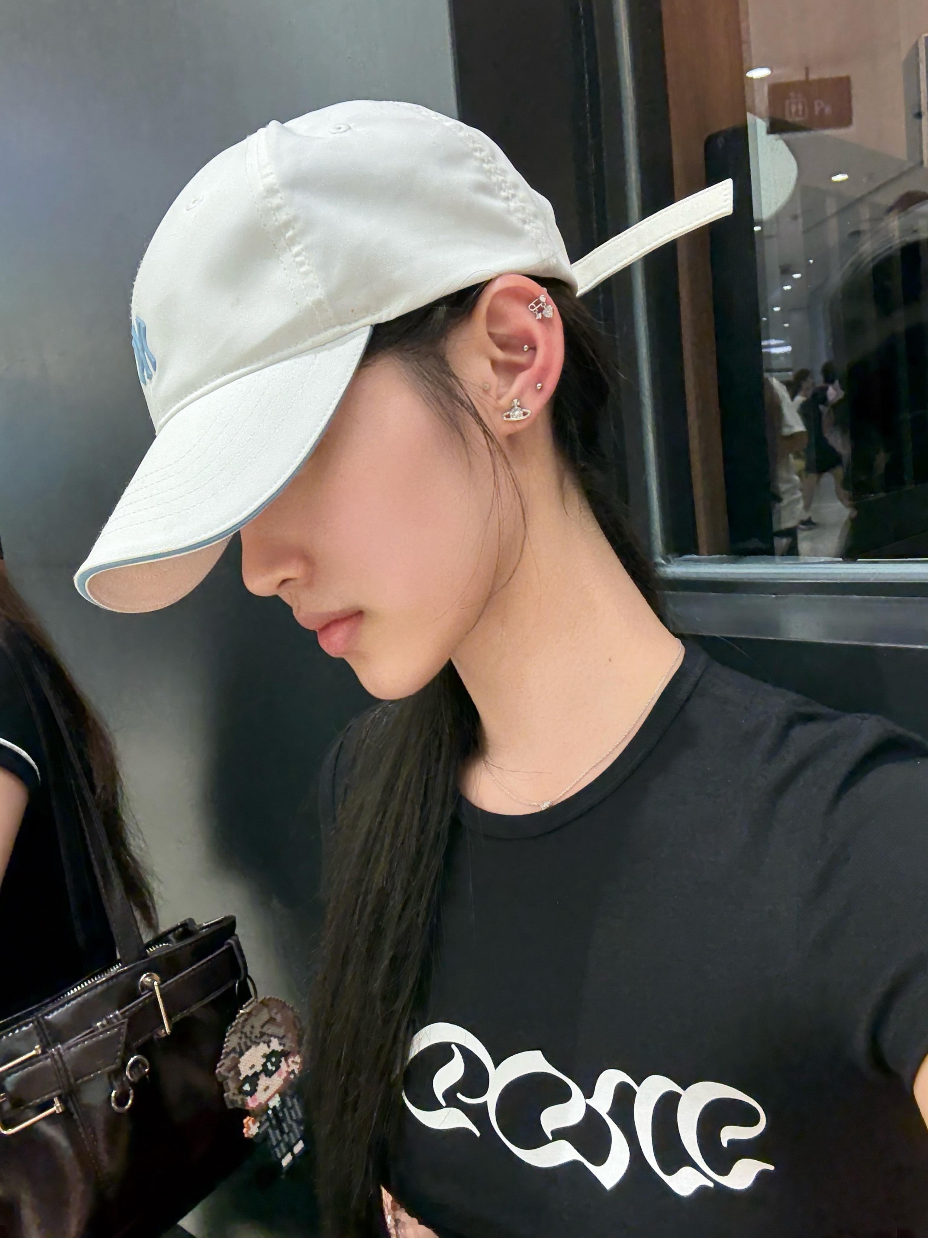 终于打了耳蜗和高耳位 耳朵现在火辣辣的 