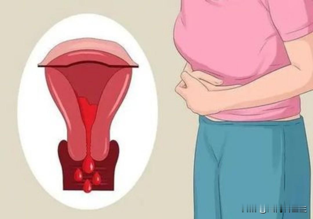 月经头一两天带血块，第三天呈粉红色是正常的吗？

医生，我的月经头一两天带血块，