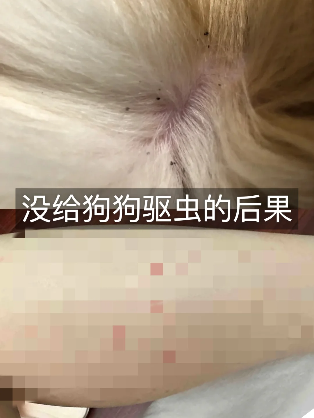 求寄生虫从这个世界上消失！！防不胜防