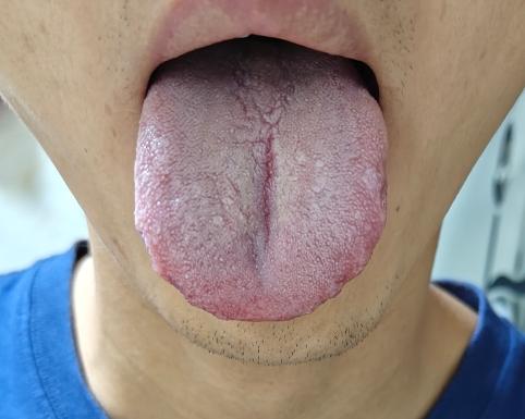 看看你舌头，你自己不愁，我看了都苦恼！
这舌头不调理，你在等啥呢[what][w