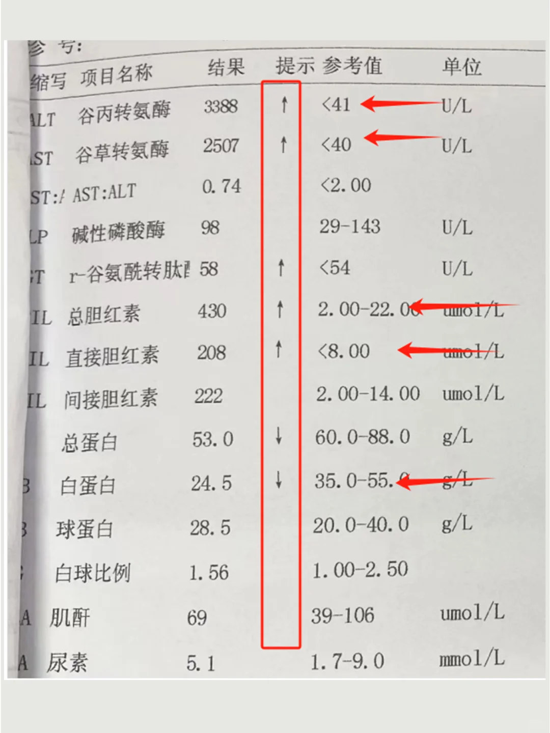 令人担忧！这样的肝功能单子……