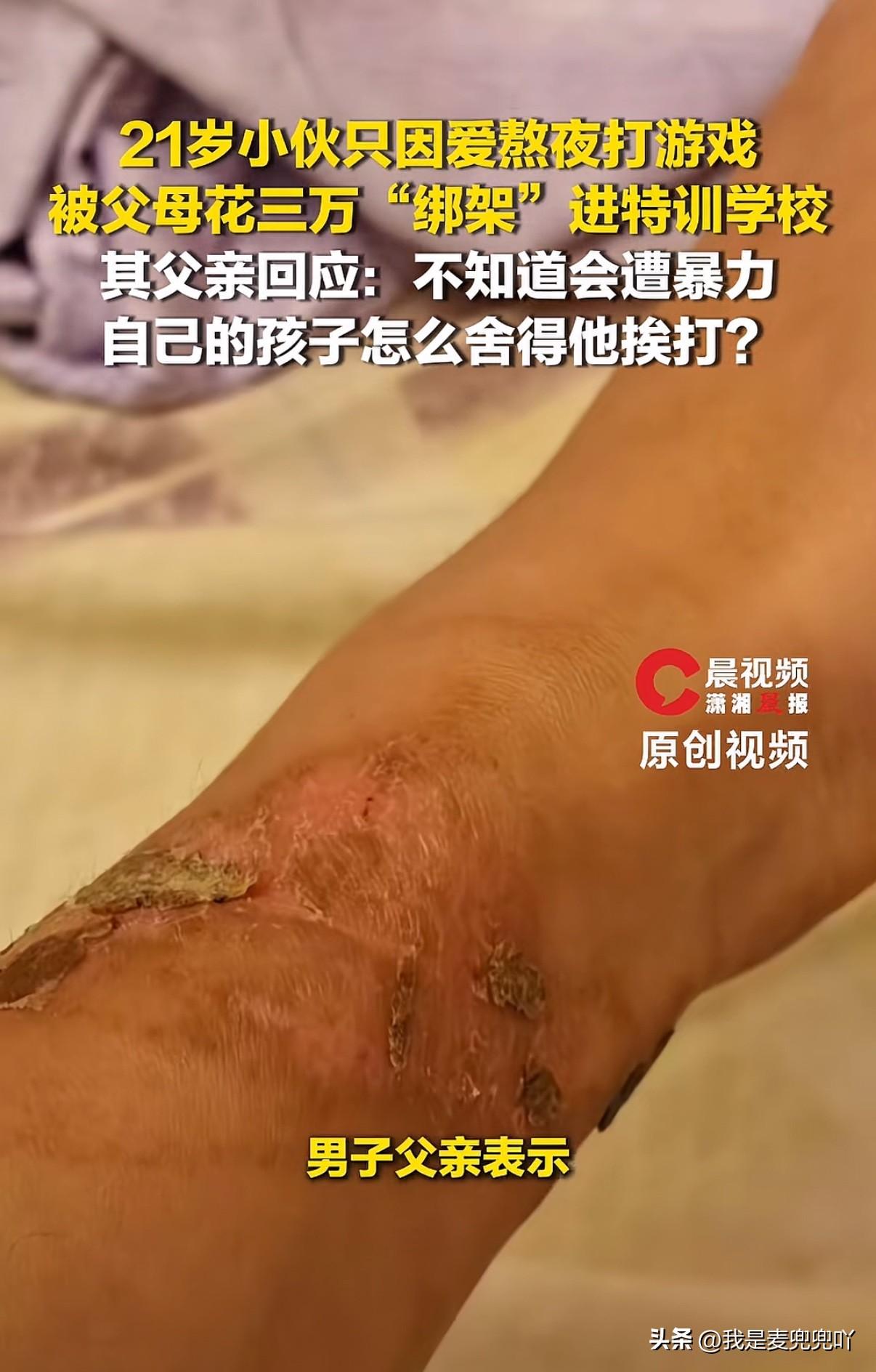 细思极恐！21岁男子自己开板材店经济独立无不良嗜好只因为爱熬夜刷手机就被父母花3
