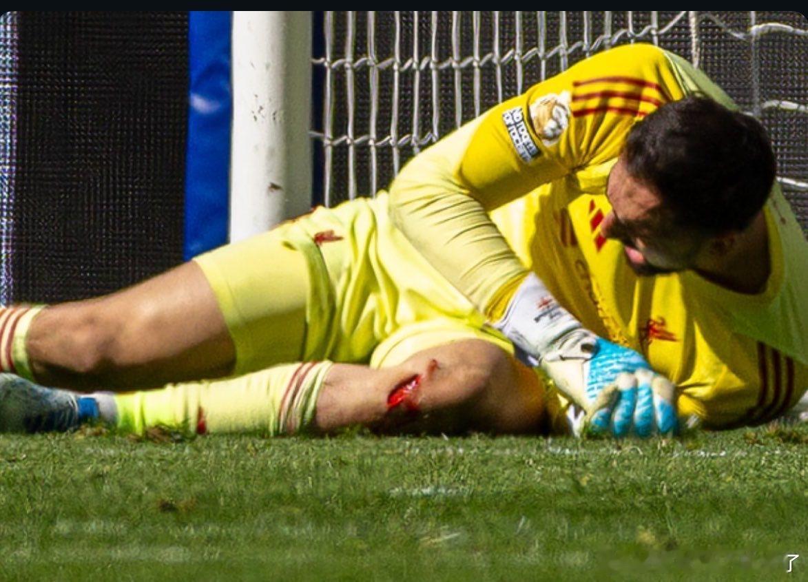 马马达这伤口的口子有点大啊 （害怕别点大图） 