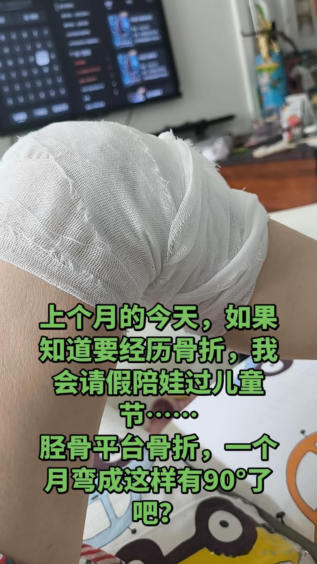有没有胫骨平台骨折的折友们？是不是也在焦虑的练角度？！[捂脸]
我帮大家问过了，