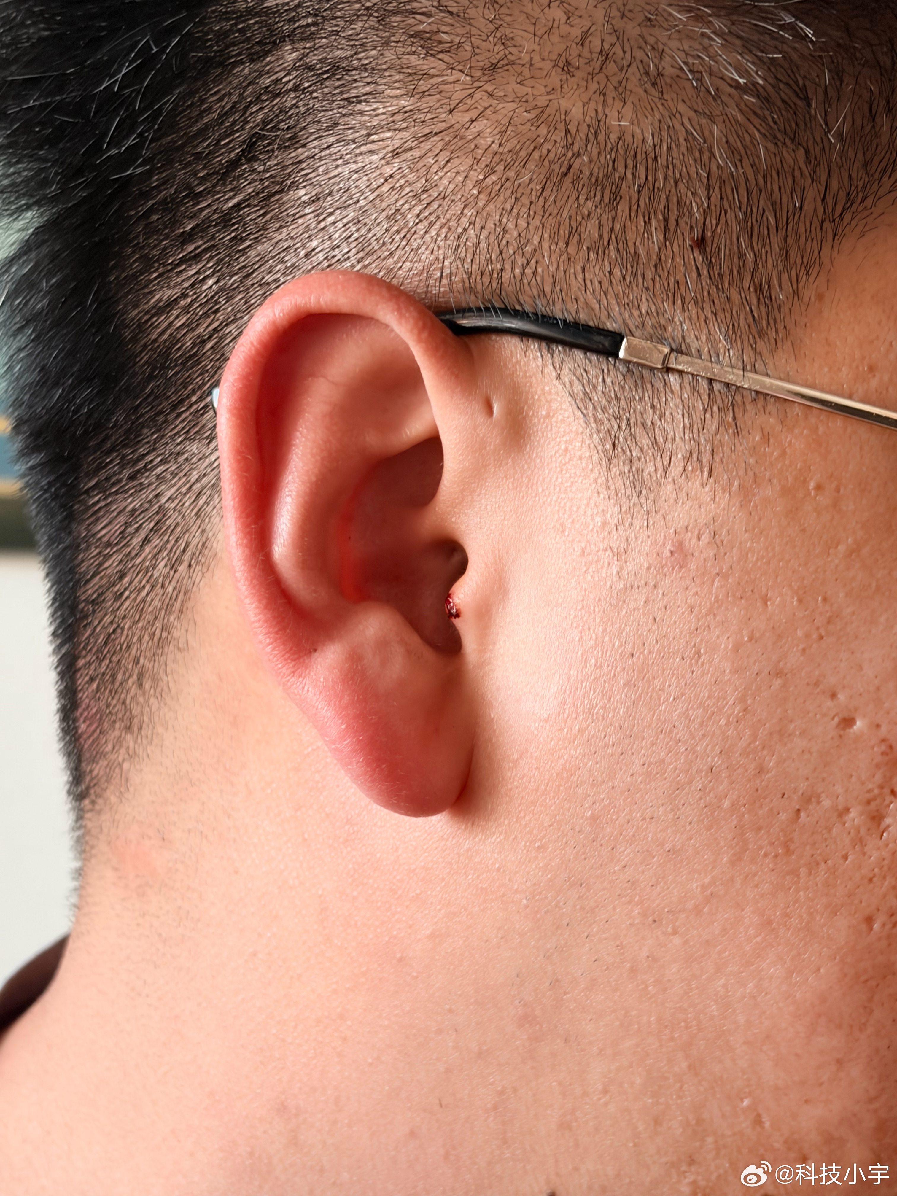 被自己蠢哭了，刮胡子一刀刮耳朵上了